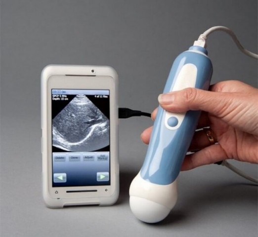 Personālais ultrasonogrāfijas aparāts, kuru var pievienot viedierīcei